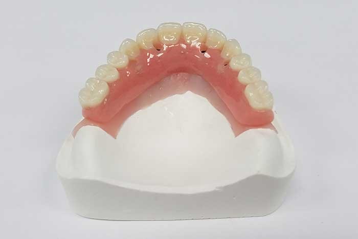 Wax Spacer Designs In Complete Dentures Shoreham VT 5770